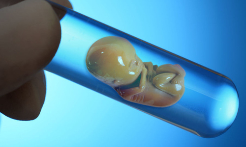 Em bé thụ thai trong ống nghiệm cần được chăm sóc và cung cấp đủ chất đạm cần thiết
